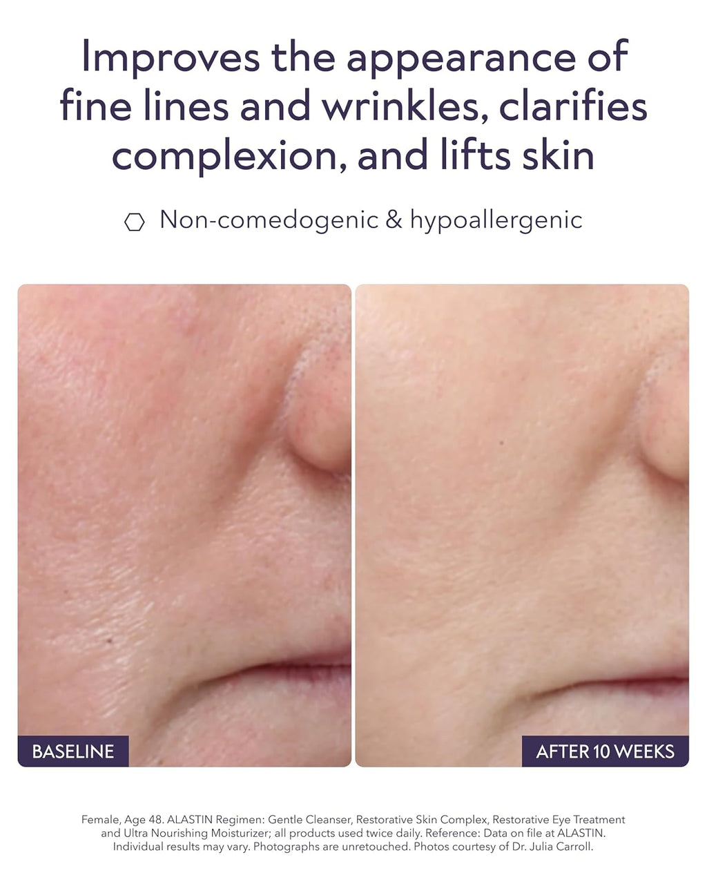 Alastin Restorative Skin Complex with TriHex+™ – Advanced Radiance & Firmness Serum (1.0 fl oz)